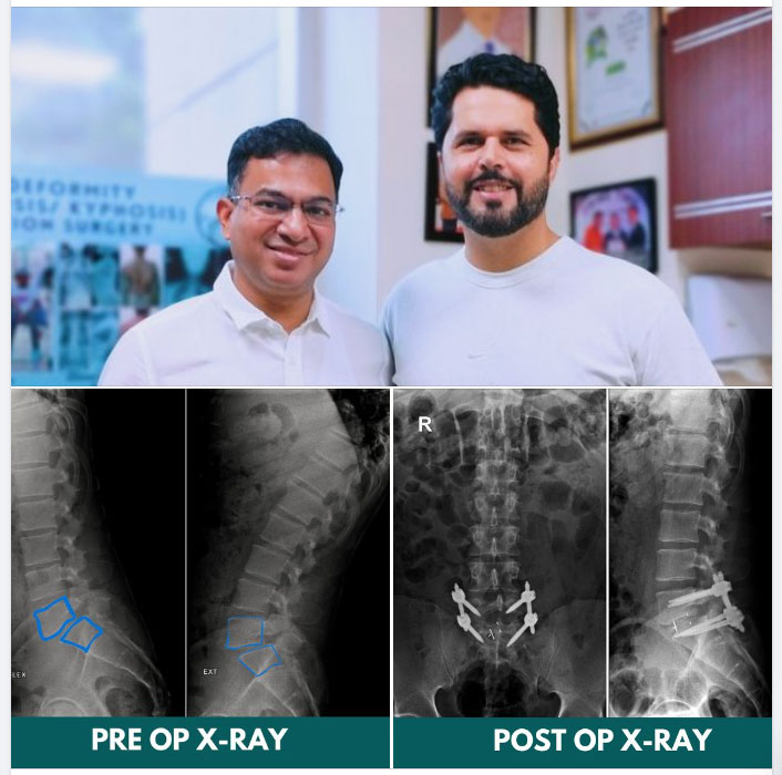 Success Story: Journey to Pain-free Life