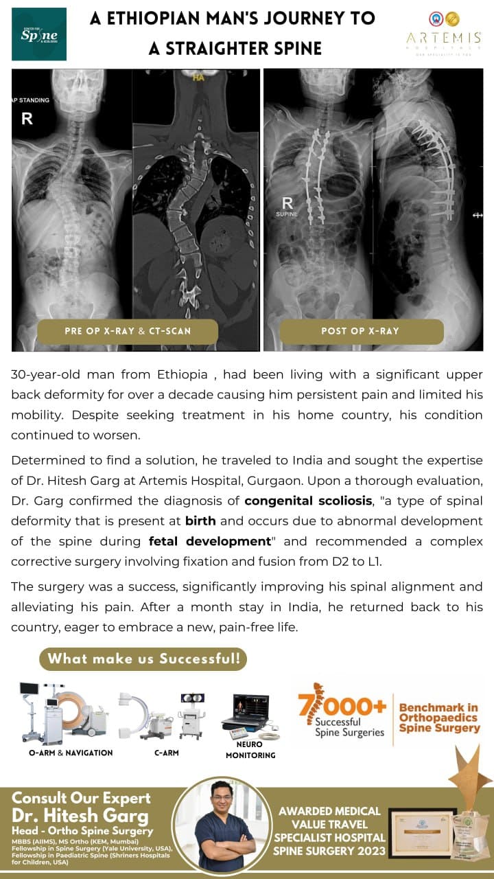 Kyphosis Surgery