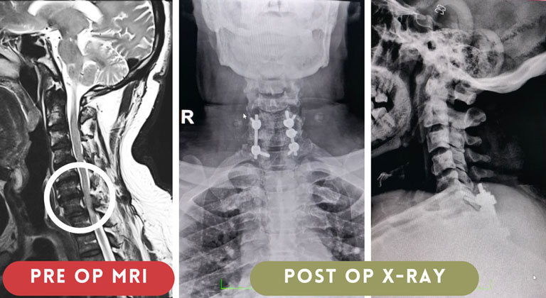 Success Story: A reminder of the importance of thorough Diagnosis